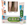 Ultimate Varicose Veins Treatment Cream
